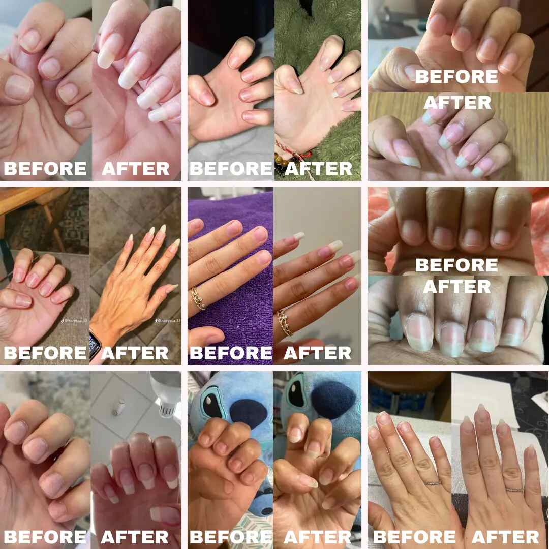 Natural Nail Growth Oil
