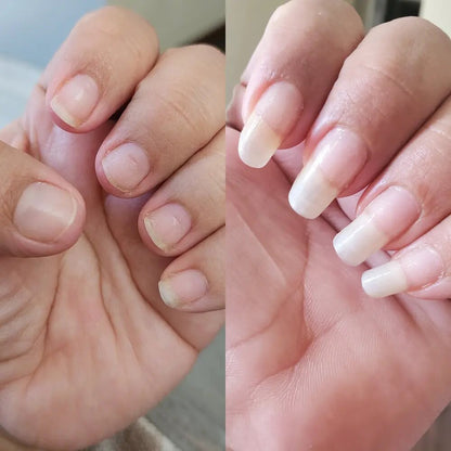 Natural Nail Growth Oil