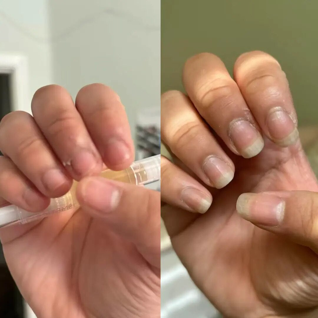 Natural Nail Growth Oil