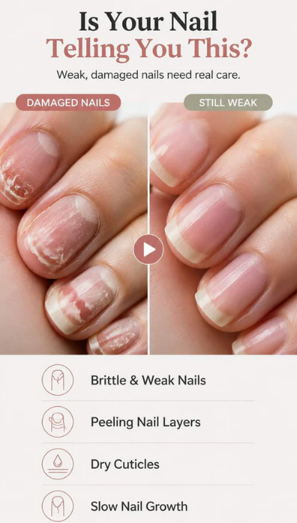 Natural Nail Growth Oil